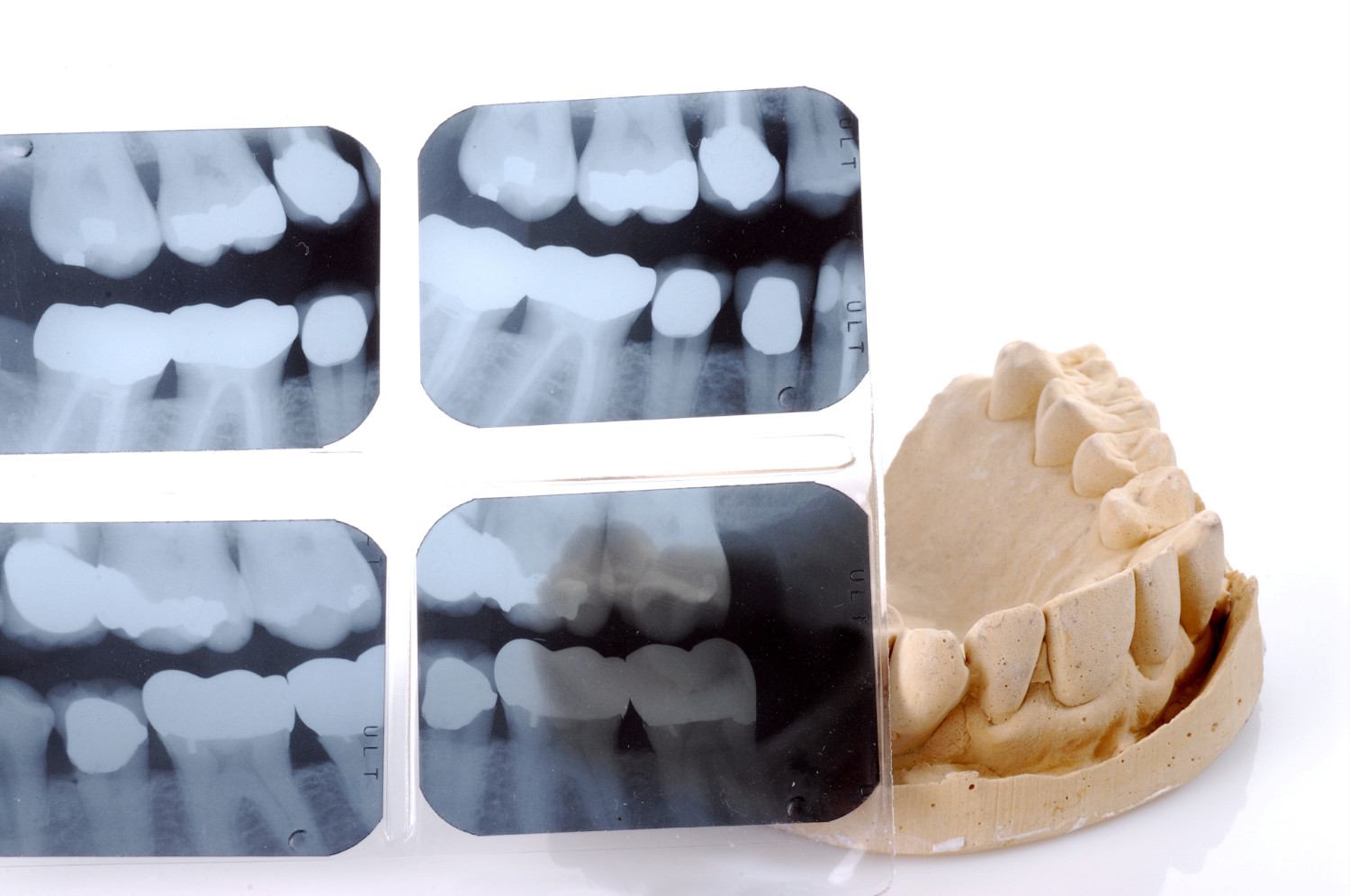 Digital Dental XRays Coppe + Sears Lexington Pediatric Dentistry